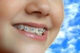 aparat_dentar_mica aparat_dentar_mica