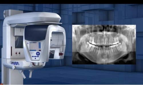Radiografie dentara Bucuresti