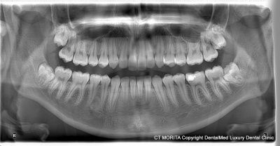 panoramic_rx_dentalmed_400