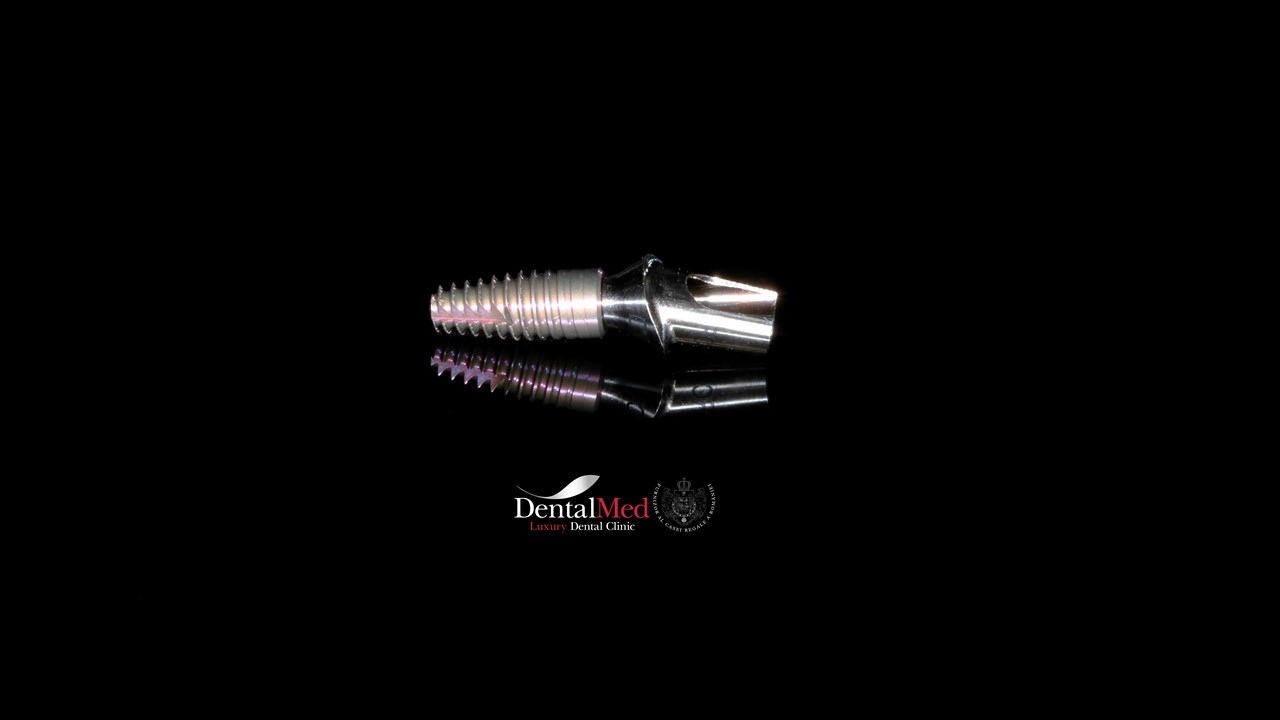 Implant dentar premium in Bucuresti 3 Implant dentar Straumann