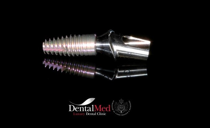 Pret Implant dentar Straumann cu bont protetic