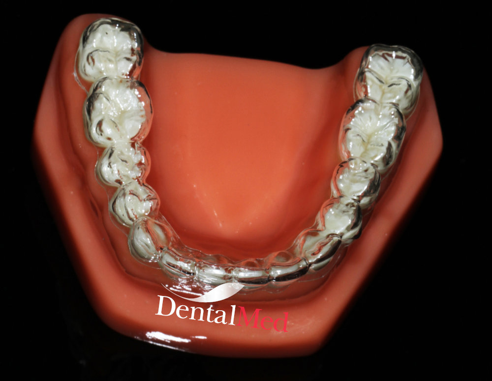Aparat dentar Gutiere transparente INVISALIGN