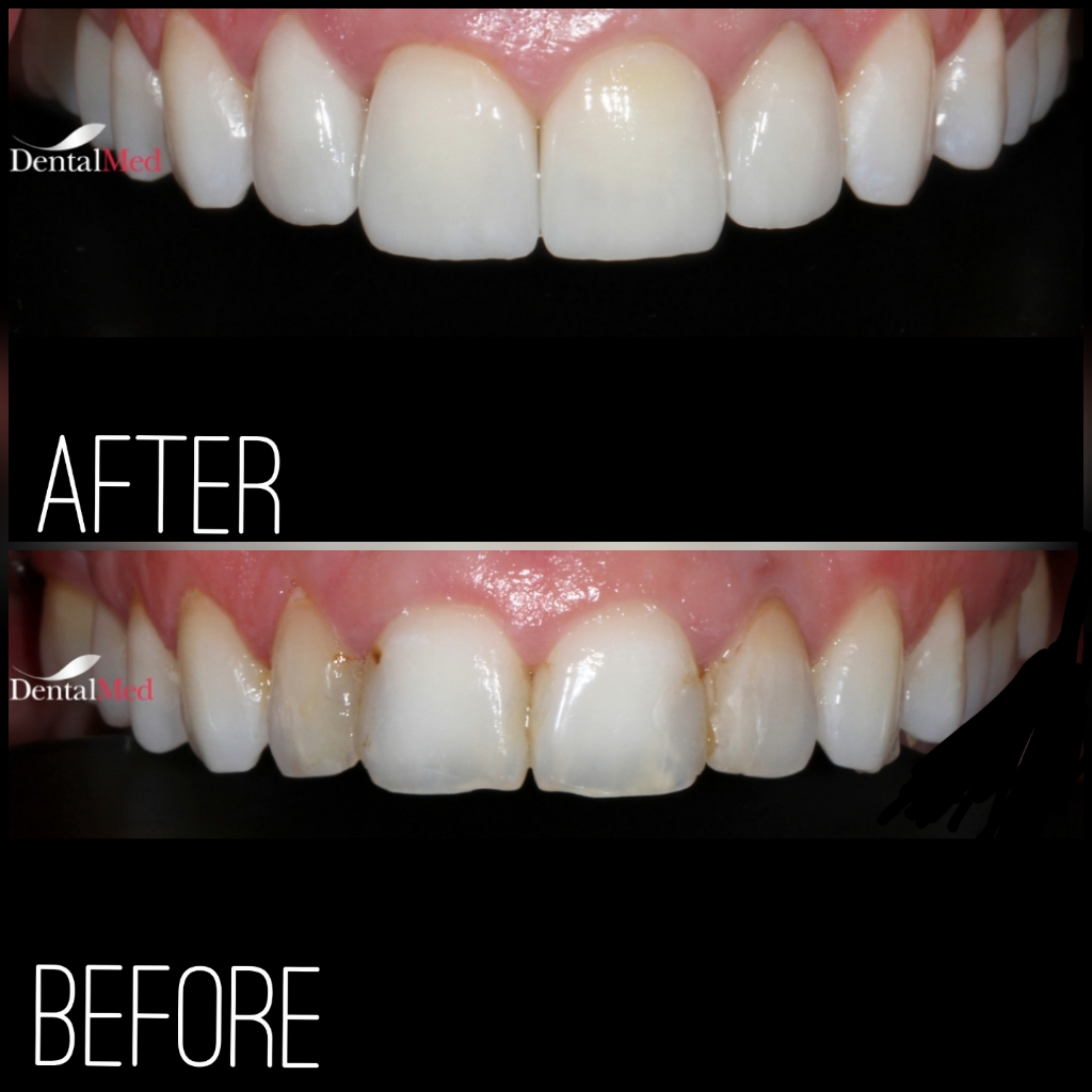 quicksquarenew 201965215822134 Protetica dentara si estetica dentara Bucuresti
