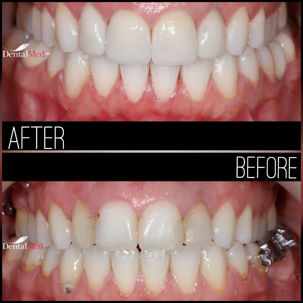 quicksquarenew 20196522150360 Protetica dentara si estetica dentara Bucuresti