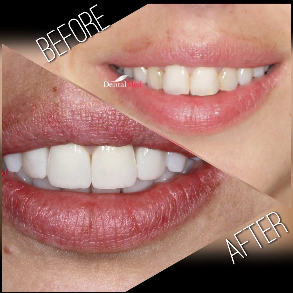 quicksquarenew 201965221739445 Protetica dentara si estetica dentara Bucuresti
