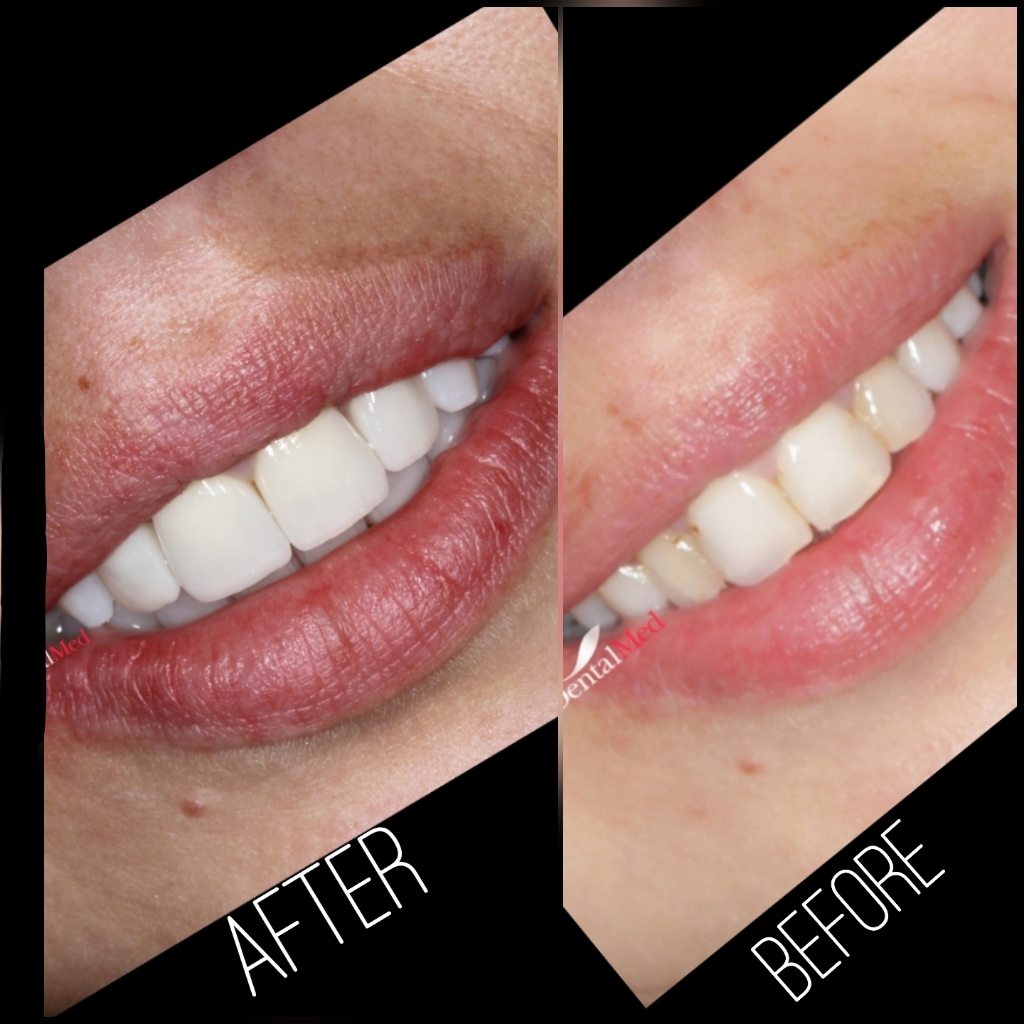 quicksquarenew 201965223751268 Protetica dentara si estetica dentara Bucuresti