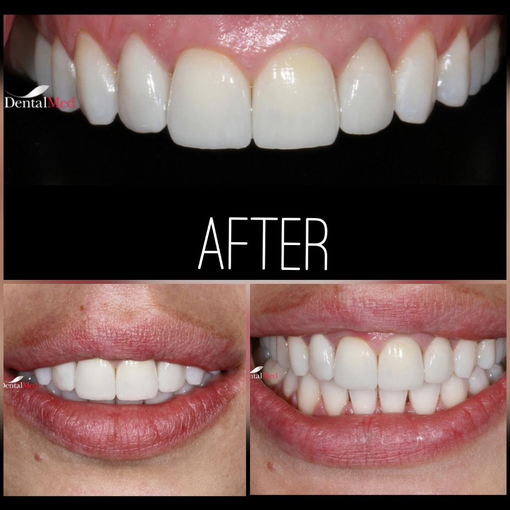 quicksquarenew 201965224618951 Protetica dentara si estetica dentara Bucuresti