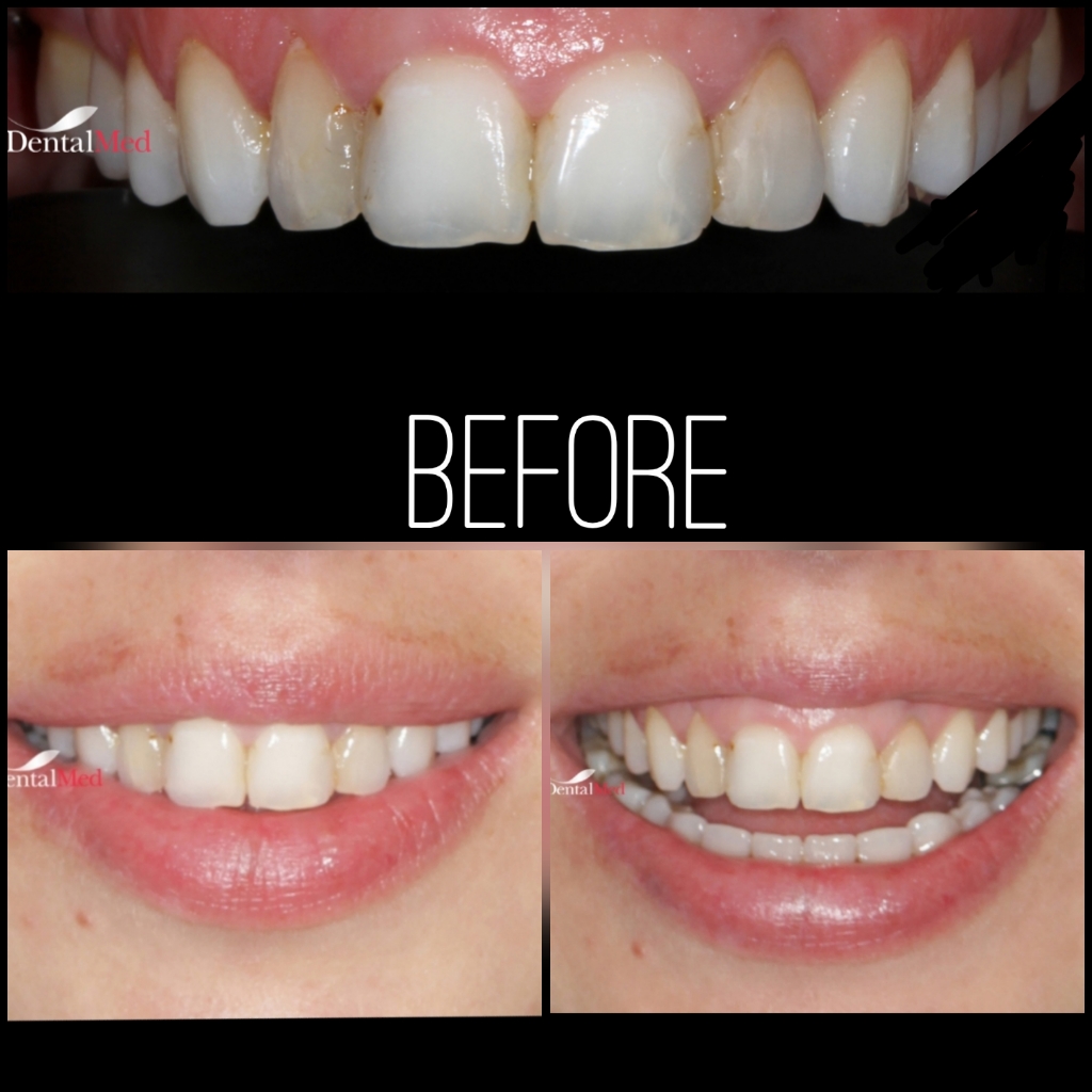 quicksquarenew 20196522512662 Protetica dentara si estetica dentara Bucuresti