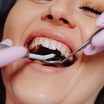 Retracție gingivală: ce este? Soluții pentru recâștigarea zâmbetului perfect și a sănătății dinților 3 gingivita