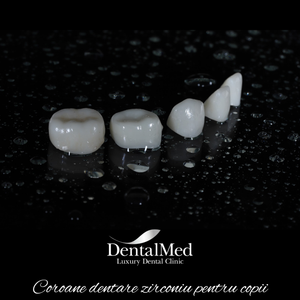 20220630 084542 0001 Coronite dentare pentru copii