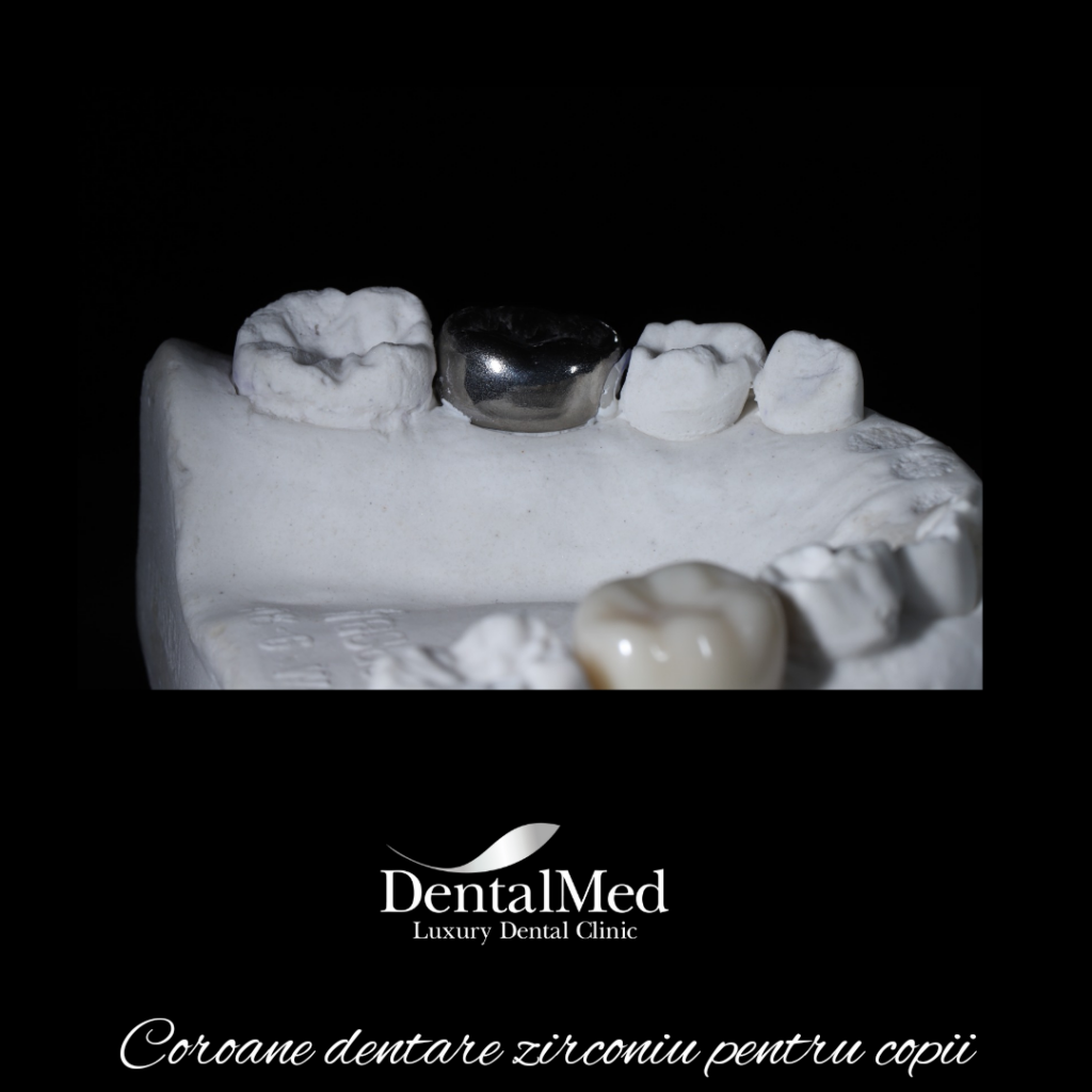 20220630 084542 0003 Coronite dentare pentru copii