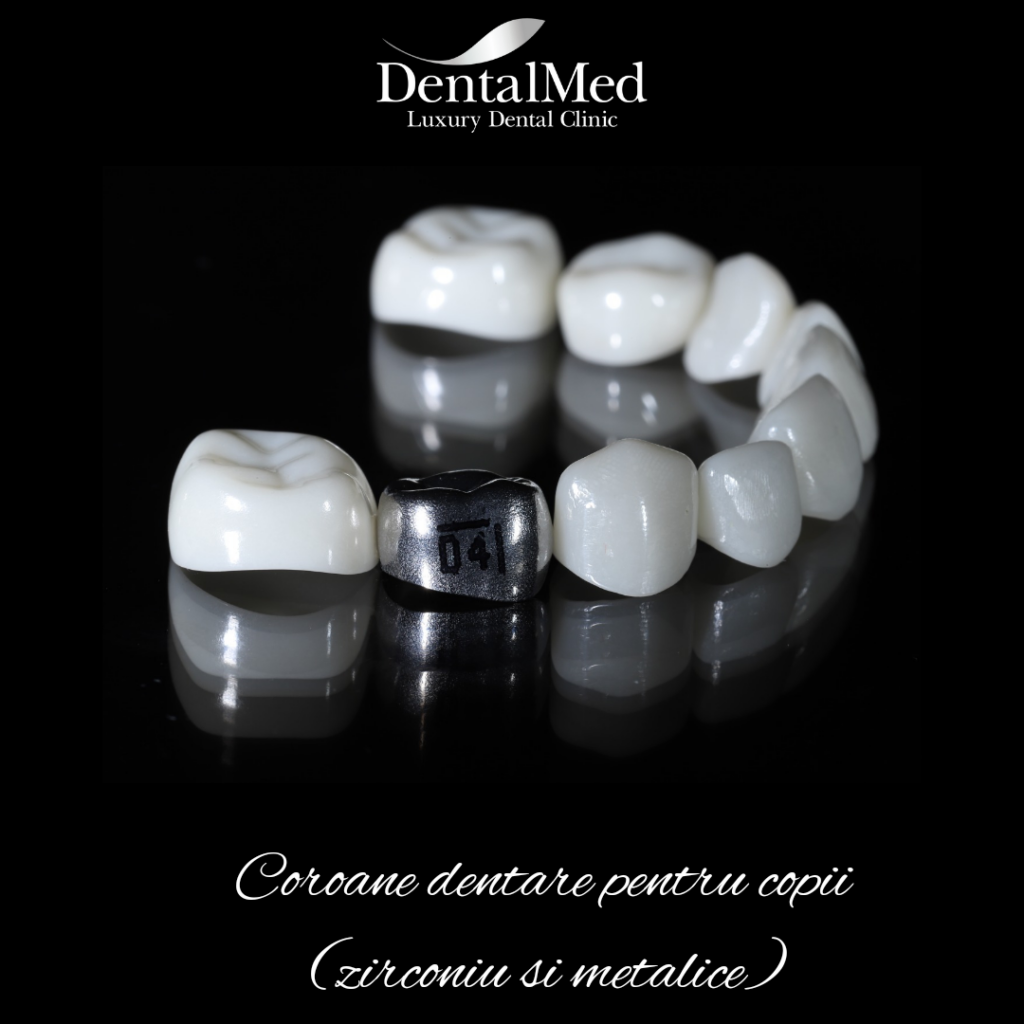 20220630 085401 0000 Coronite dentare pentru copii