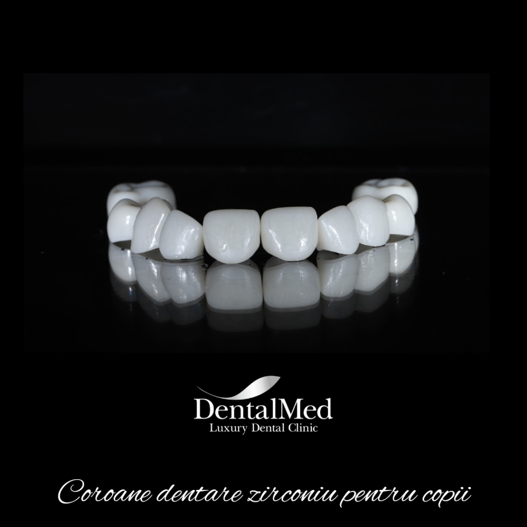 20220630 085504 0000 Coronite dentare pentru copii