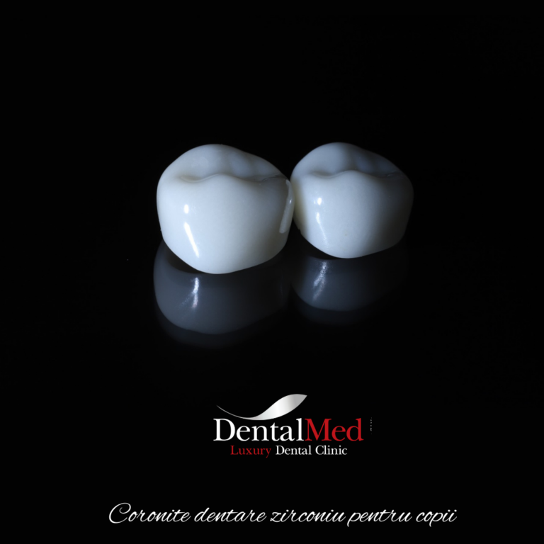 coronite dentare copii