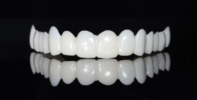 fatete dentare universale Adevărul despre Fatetele Dentare Universale disponibile în Farmacii si Magazine Online