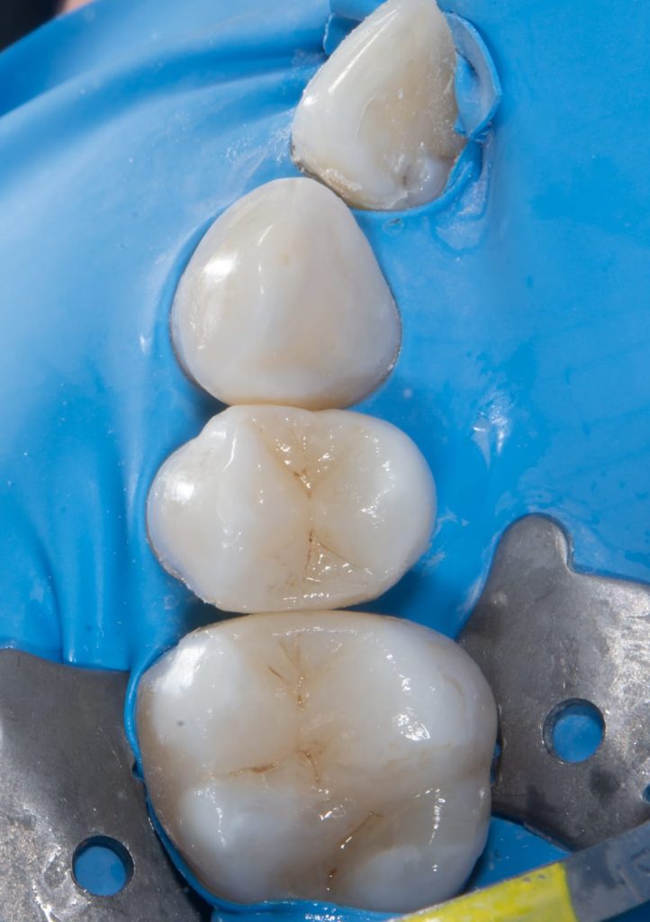 WhatsApp Image 2024 04 03 at 16.21.37 Plombe Dentare Moderne
