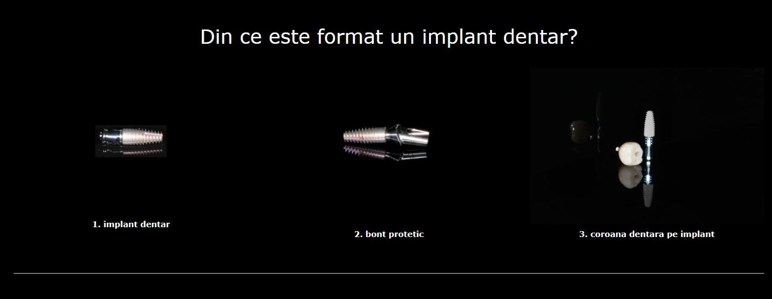 09.10 bont protetic implant dentar 2 Bont protetic implant dentar. Un element esential al interventiei!