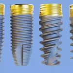 10.10 biocompatibilitate Biocompatibilitatea, esentiala in succesul unui tratament cu implant dentar!