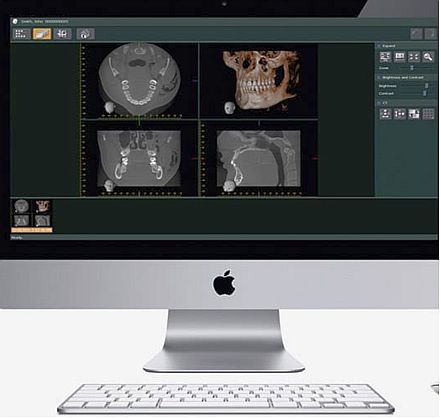 CBCT dentar. O componenta esentiala in succesul unui implant dentar! 1 10.10 cbct dentar CBCT dentar. O componenta esentiala in succesul unui implant dentar!