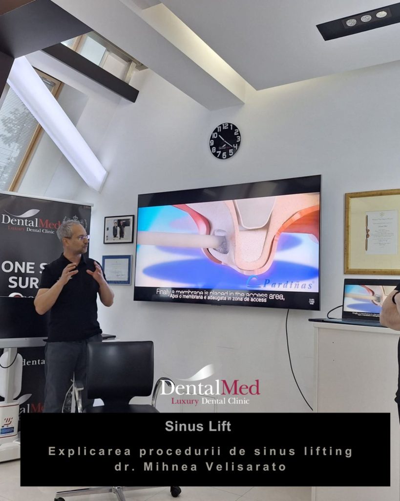 06.11 sinus lift implant dentar.jpg 1 Sinus lift implant dentar. Ce este aceasta procedura si cand e necesara?