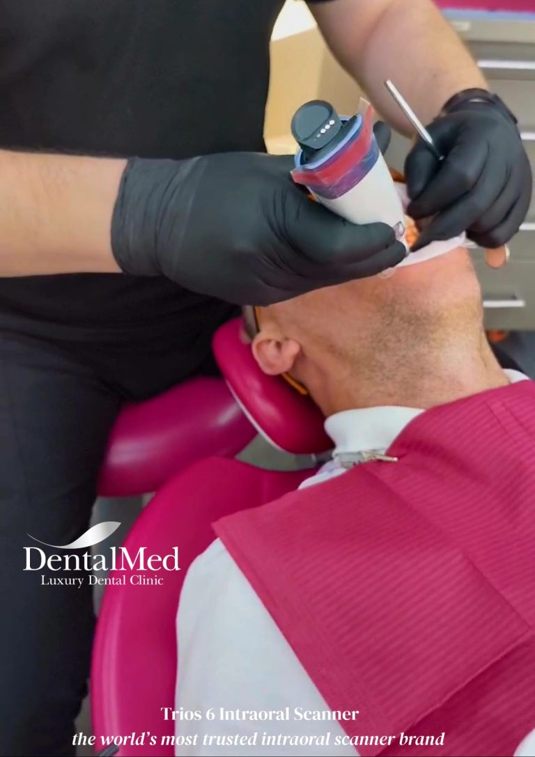 scanner intraoral trios 6 3 Scanare intraorala implant dentar. Ce este si ce rol are aceasta procedura?