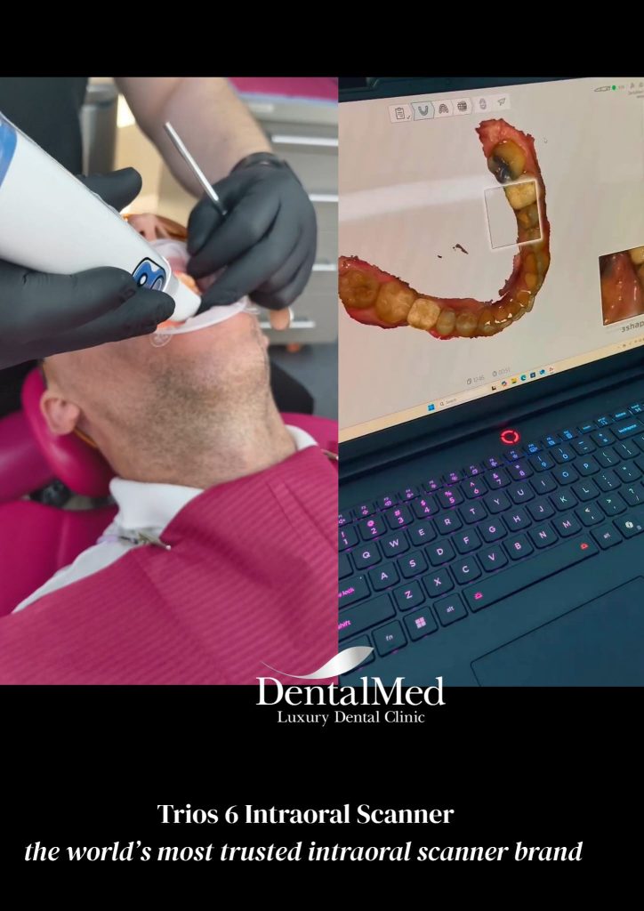 scanner intraoral trios 6 4 DentalMed Luxury, prima clinică din România cu noul scanner intraoral Trios 6 de la 3Shape
