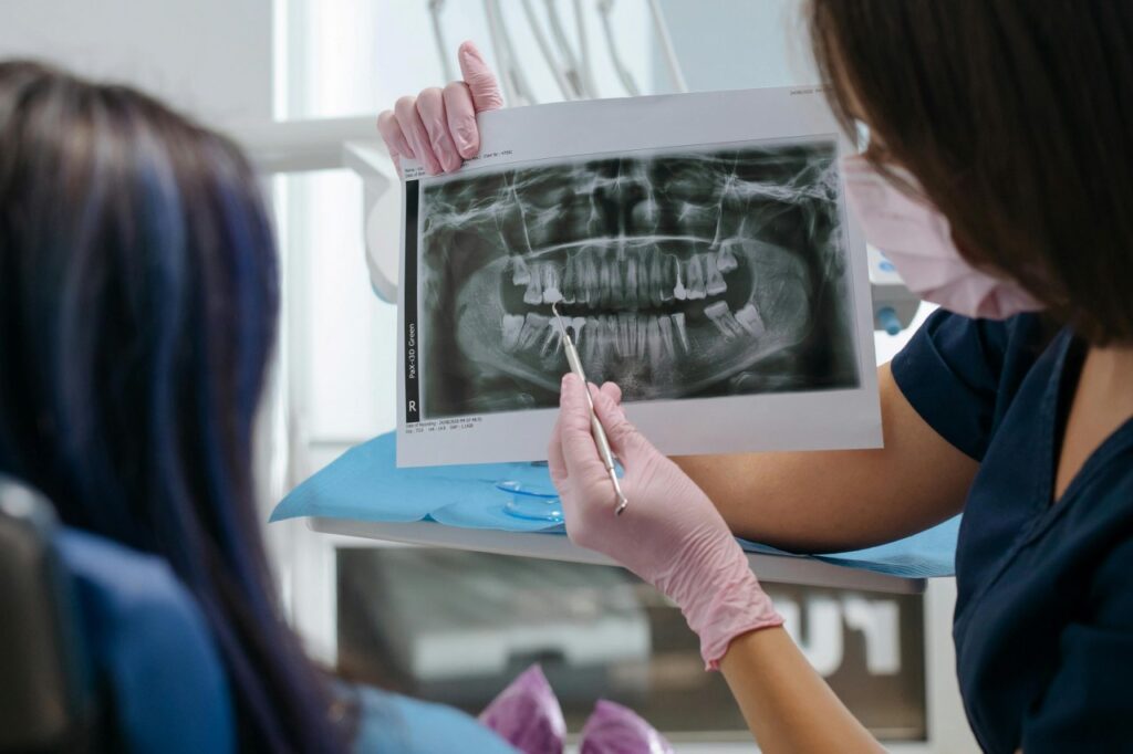 aparat dentar daca am implant dentar 1 Pot purta aparat dentar dacă am implant dentar?