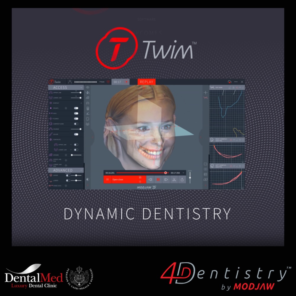 Îmi trosnește maxilarul când deschid gura sau simt blocaj? Cauze și când trebuie să mă îngrijorez 3 41 20240321 110036 0001 Îmi trosnește maxilarul când deschid gura sau simt blocaj? Cauze și când trebuie să mă îngrijorez