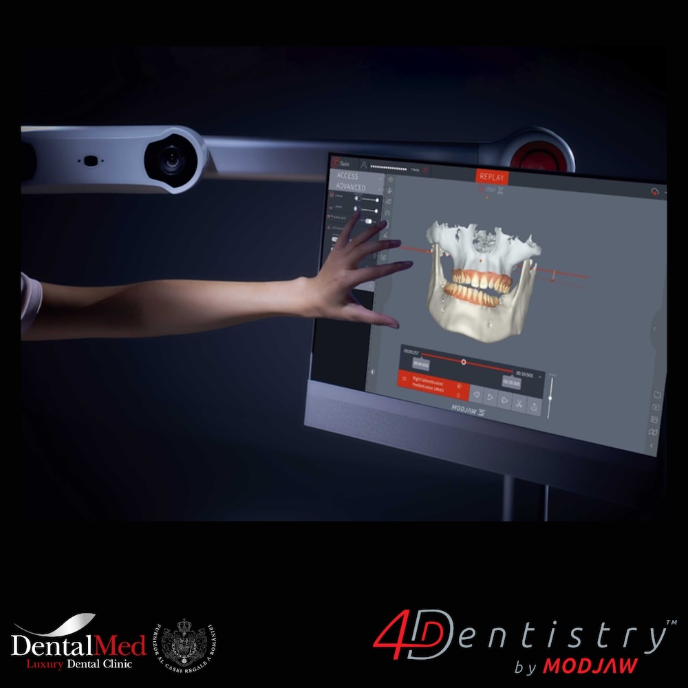 Îmi trosnește maxilarul când deschid gura sau simt blocaj? Cauze și când trebuie să mă îngrijorez 2 42 20240321 110036 0002 Îmi trosnește maxilarul când deschid gura sau simt blocaj? Cauze și când trebuie să mă îngrijorez