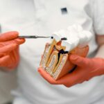 carie interdentara 1 Carie interdentară: cauze, simptome și soluții moderne de tratament
