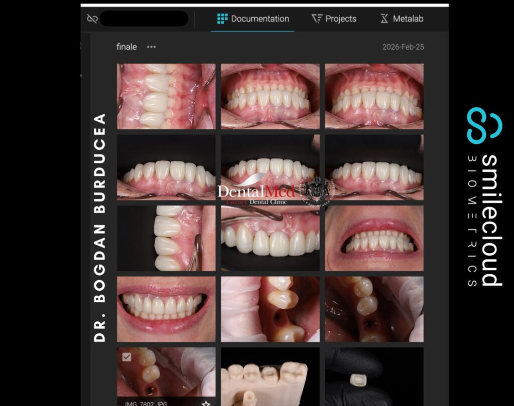 Smilecloud - Digital Smile Design powered by A.I. la DentalMed Luxury 1 Digital Smile Design cu Smilecloud