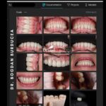 Digital Smile Design cu Smilecloud