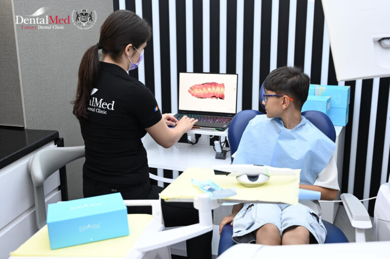 Aparat dentar copii Spark Junior