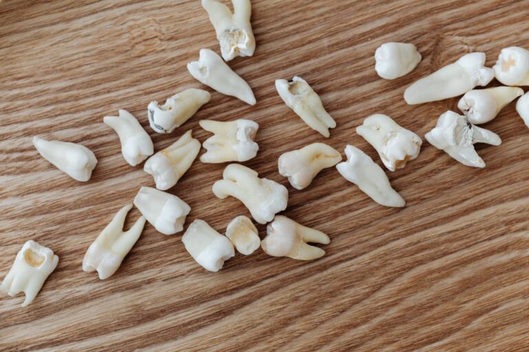 ce este avulsia dentara 1 Ce este avulsia dentară și de ce este o urgență stomatologică: pierderea completă a unui dinte și pașii corecți în caz de urgență