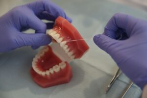 intra mereu mancare intre aceiasi doi dinti 2 Îți intră mereu mâncare între aceiași doi dinți? Iată ce problemă poate indica 