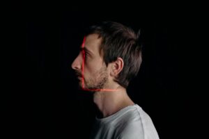 retrognatismul mandibular 1 Cum recunoști retrognatismul mandibular și când este necesar tratamentul