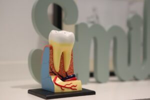 simptome pulpita dentara 1 Simptome pulpită dentară: cum îți dai seama că nervul dintelui este afectat