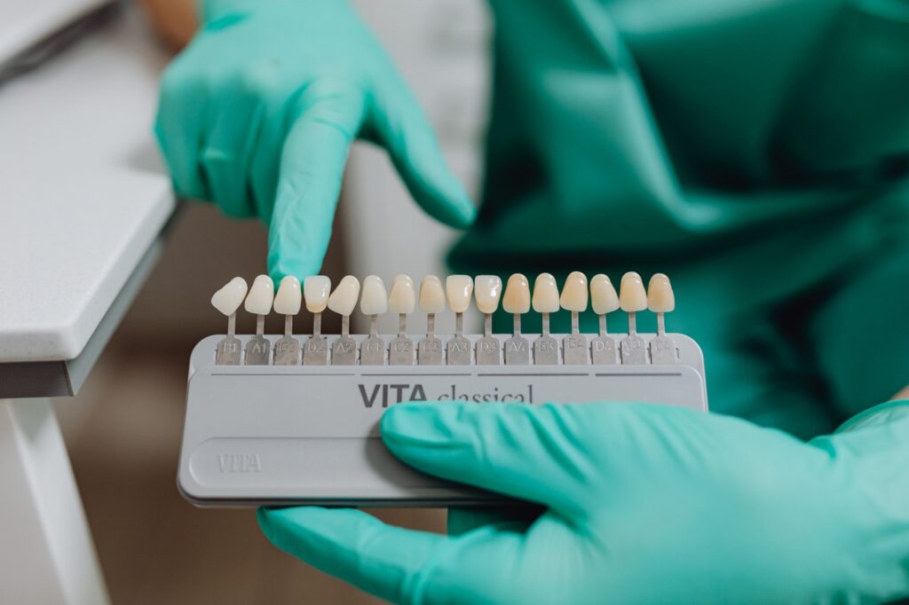 Tipuri de coroane dentare: materiale, avantaje și cum alegi varianta potrivită 1 tipuri de coroane dentare 1 Tipuri de coroane dentare: materiale, avantaje și cum alegi varianta potrivită