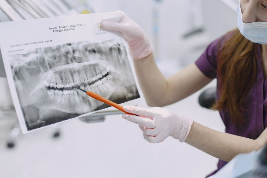 Tratament pentru granulomul dentar: ce soluții există pentru salvarea dintelui? 1 tratament granulom dentar 2 Tratament pentru granulomul dentar: ce soluții există pentru salvarea dintelui?