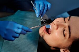 implant imediat si incarcare imediata 1 Implant imediat și încărcare imediată: care este diferența și când pot fi luate în calcul?