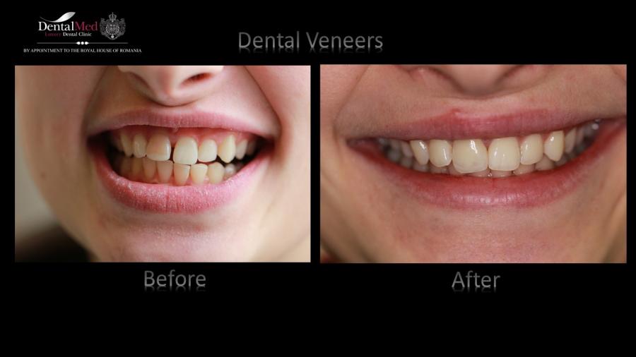 Dotari%20DentalMed march%202016 Protetica dentara si estetica dentara Bucuresti